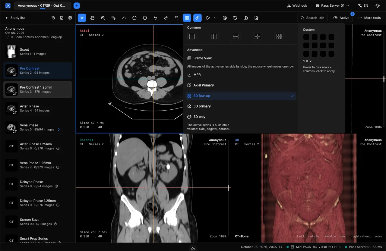 Menu tata letak HISGrace DICOM Viewer dengan pilihan grid umum, Frame View, MPR, Axial Primary, 3D four up, dan grid kustom