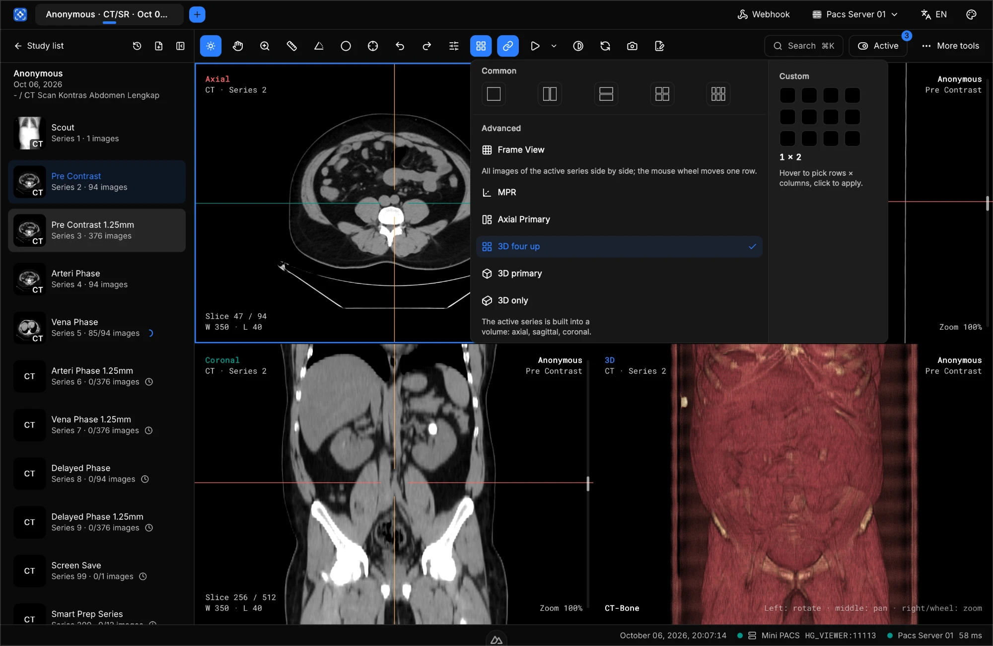 HISGrace PACS Viewer layout menu: standard options, Frame View, MPR, Axial Primary, 3D four up, 3D primary, 3D only, and custom grid